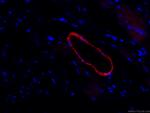 transgelin/SM22 Antibody in Immunohistochemistry (PFA fixed) (IHC (PFA))