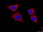 Factor XII Antibody in Immunocytochemistry (ICC/IF)