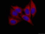 AK2 Antibody in Immunocytochemistry (ICC/IF)