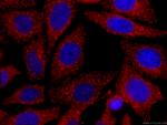 CLTC Antibody in Immunocytochemistry (ICC/IF)