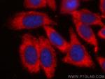 APOE Antibody in Immunocytochemistry (ICC/IF)