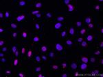 DBR1 Antibody in Immunocytochemistry (ICC/IF)