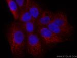 ALDH5A1 Antibody in Immunocytochemistry (ICC/IF)