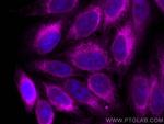 calreticulin Antibody in Immunocytochemistry (ICC/IF)