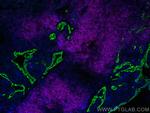 CD20 Antibody in Immunohistochemistry (PFA fixed) (IHC (PFA))