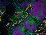 CD20 Antibody in Immunohistochemistry (PFA fixed) (IHC (PFA))