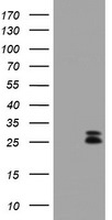 CMPK1 Antibody in Western Blot (WB)
