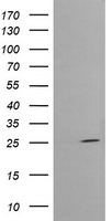 CMPK1 Antibody in Western Blot (WB)