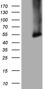 CPM Antibody in Western Blot (WB)