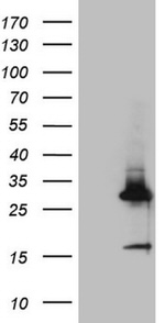 CRP Antibody in Western Blot (WB)