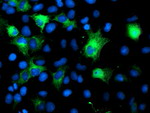 CRYAB Antibody in Immunocytochemistry (ICC/IF)