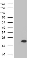 CRYAB Antibody in Western Blot (WB)