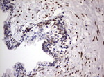 CSNK1E Antibody in Immunohistochemistry (Paraffin) (IHC (P))