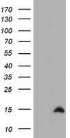 CST2 Antibody in Western Blot (WB)