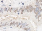 CSTF2T/TauCSTF64 Antibody in Immunohistochemistry (IHC)