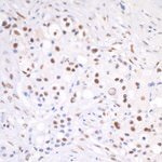 CSTF64 Antibody in Immunohistochemistry (IHC)
