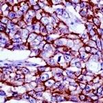 beta Catenin Antibody in Immunohistochemistry (IHC)