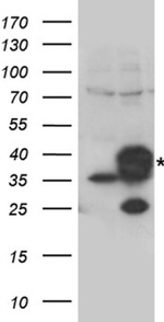 CYB5R3 Antibody in Western Blot (WB)