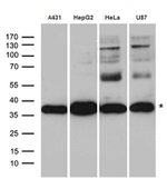 CYB5R3 Antibody in Western Blot (WB)