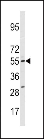 CYP11A1 Antibody in Western Blot (WB)