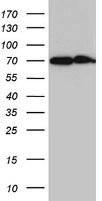 CYP26B1 Antibody in Western Blot (WB)