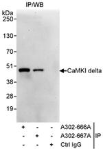 CaMKI delta Antibody in Immunoprecipitation (IP)