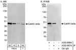 CaMKI delta Antibody in Western Blot (WB)