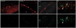 Calbindin D28K Antibody in Immunocytochemistry (ICC/IF)