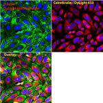 Calreticulin Antibody in Immunocytochemistry (ICC/IF)