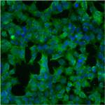 Calreticulin Antibody in Immunocytochemistry (ICC/IF)