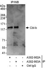 Cbl-b Antibody in Immunoprecipitation (IP)