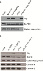 Clathrin Heavy Chain Antibody in Western Blot (WB)