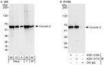 Coronin 2 Antibody in Western Blot (WB)