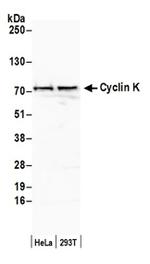 Cyclin K Antibody in Western Blot (WB)