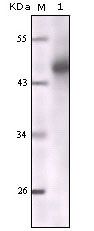 Cytokeratin 5 Antibody in Western Blot (WB)