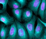 Rabbit IgG (H+L) Highly Cross-Adsorbed Secondary Antibody in Immunocytochemistry (ICC/IF)