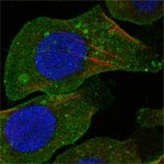 DDR2 Antibody in Immunocytochemistry (ICC/IF)