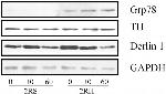 DERL1 Antibody in Western Blot (WB)