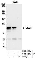 DIEXF/C1orf107 Antibody in Western Blot (WB)