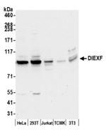 DIEXF/C1orf107 Antibody in Western Blot (WB)