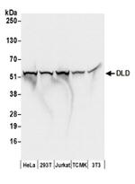 DLD Antibody in Western Blot (WB)