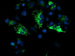 DLD Antibody in Immunocytochemistry (ICC/IF)