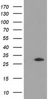 DNAJB2 Antibody in Western Blot (WB)