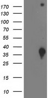 DNAJB2 Antibody in Western Blot (WB)