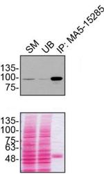 Dynamin 1 Antibody in Immunoprecipitation (IP)