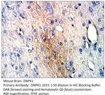 DNA PKcs Antibody in Immunohistochemistry (IHC)