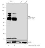 Myeloperoxidase Antibody