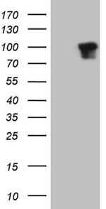 DVL2 Antibody in Western Blot (WB)