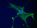 Desmin Antibody in Immunocytochemistry (ICC/IF)