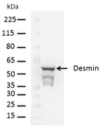 Desmin Antibody in Western Blot (WB)